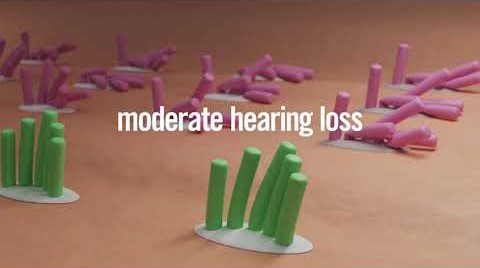Understanding Hearing Loss in Children - Nemours Children's Health System
