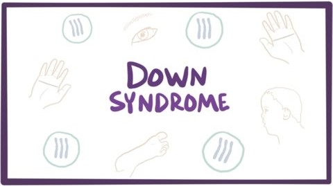 Down Syndrome (trisomy 21)